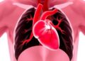 Predicting Coronary Artery Aneurysms in Kawasaki Disease — Technology and Engineering