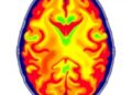 Resting-State fMRI Reveals How Visual Status Influences Walking-Related Brain Activity in Healthy Young Adults — Technology and Engineering