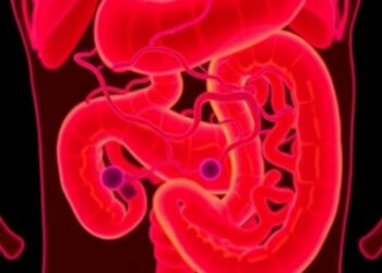 Rhein Alleviates Intestinal Damage in Severe Acute Pancreatitis by Modulating Macrophage Activation via PPARγ — Biology