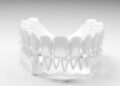 Simple Adjustment in 3D Printing Enhances Fit of Dental Crowns — Chemistry