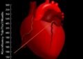 Stability and Accuracy of Framingham Heart Risk Models — Technology and Engineering