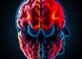 Stanford Medicine Researchers Identify Migraine Headache Subtypes Through Brain Imaging — Medicine