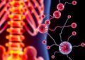 Targeting MDK Inhibition: A Promising New Approach to Combat Bone Loss — Biology