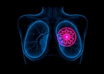AI May Predict Breast Cancer Up to 6 Years Before Diagnosis — Technology and Engineering