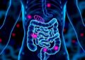 Cell-Specific Genetics Drive Inflammatory Bowel Risk — Medicine