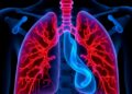 Hyperoxia, Lung Injury, and New Bronchopulmonary Dysplasia Treatments — Technology and Engineering