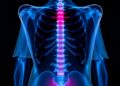 Lightweight X-Ray Aprons: A Breakthrough to Prevent Chronic Pain in Health-Care Workers — Chemistry