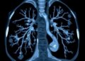 Lung Ultrasound Advances in Childhood Necrotizing Pneumonia — Technology and Engineering