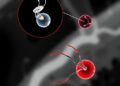 Micro/Nanorobotic Systems Enable Imaging-Guided Closed-Loop Thrombus Recanalization — Technology and Engineering