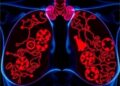 Notch2 Signaling: A Crucial Factor in Breast Cancer Dormancy Within Bone Marrow — Biology