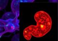 Novel Experimental Compounds Induce Cancer Cell Death in KRAS-Driven Pancreatic Tumors — Cancer
