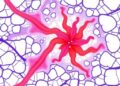 Pathomics and Clinical Data Boost Pediatric Tumor Recurrence Prediction — Technology and Engineering