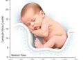 Postnatal Bilirubin Rise Predicts Newborn Health — Technology and Engineering