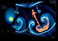 Real-Time 3D Ultrasound Boosts AR Training Success — Technology and Engineering