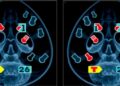 Tracking AI Mammogram Risk Score Changes Over Time Enhances Future Breast Cancer Prediction — Technology and Engineering