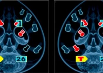 Tracking AI Mammogram Risk Score Changes Over Time Enhances Future Breast Cancer Prediction — Technology and Engineering
