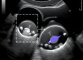 Ultrasound Elastography Advances Fetal Rabbit Lung Assessment — Technology and Engineering