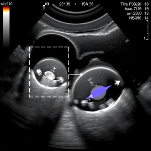 Ultrasound Elastography Advances Fetal Rabbit Lung Assessment
