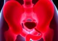 Urothelial Changes Increase UTI Risk Post-VCUG — Technology and Engineering