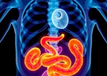 AI Model Predicts Necrotizing Enterocolitis Diagnosis and Surgical Outcomes