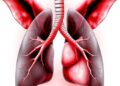 Aortic arch surgery in piglets shows similar lung injury with or without distal perfusion
