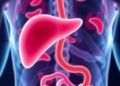 Blood Test Detects 90% of Early-Stage Pancreatic Cancer