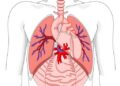 Cardiac Adaptation in Congenital Diaphragmatic Hernia — Technology and Engineering