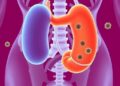 Combined phage therapy and faecal microbiota transplantation to treat recurrent urinary tract infection: a case series