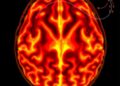 Dual-Frequency Photoacoustic CT Reveals Clear Whole Brain, Centimeters Deep