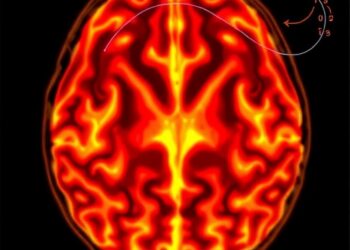Dual-Frequency Photoacoustic CT Reveals Clear Whole Brain, Centimeters Deep