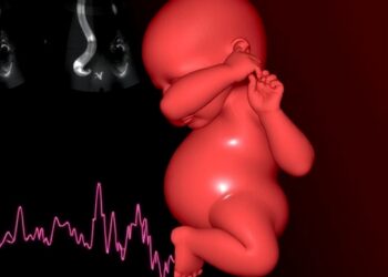 Echocardiography Hemodynamics in Preterm Infants Predict Neurodevelopment Through Age Three