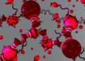 Epigenetic Variation Shapes Chromatin in Acute Myeloid Leukemia