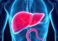 Fatty Liver Accelerates Aggressive Cancer Metastasis — Biology