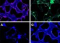 Hepatic IFRD1 Alleviates Metabolic Dysfunction-Linked Steatohepatitis Through the GLUD1/α-KG Pathway — Biology