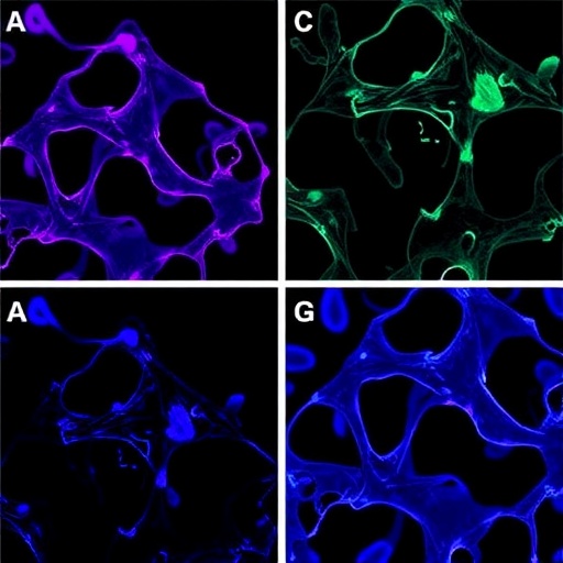 Hepatic IFRD1 Alleviates Metabolic Dysfunction-Linked Steatohepatitis Through the GLUD1/α-KG Pathway — Biology