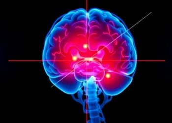 KAIST Creates AI to Detect Early Cerebrovascular Disease Signs at Home