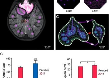 LIG1 Loss Reveals Targetable Weakness Against Chemotherapy-Resistant Triple-Negative Breast Cancer
