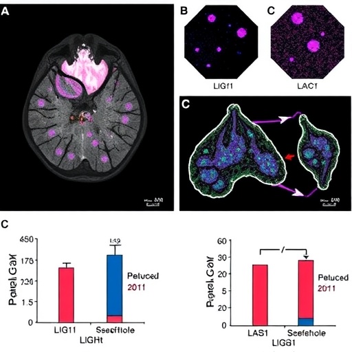 LIG1 Loss Reveals Targetable Weakness Against Chemotherapy-Resistant Triple-Negative Breast Cancer