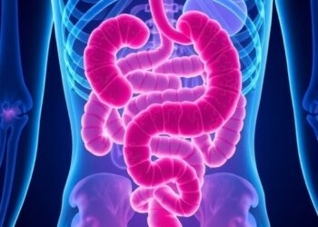Necrotizing Enterocolitis: A Paradigm Shift in Understanding