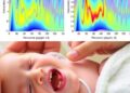 Noninvasive Acoustic Assessment of Feeding Skills in Preterm Infants With BPD