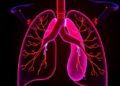Pilot study to validate endothelium collection from pulmonary artery balloon catheter in children