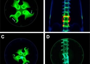 Senolytic PROTAC Slows Age-Related Intervertebral Disc Degeneration in Male Mice