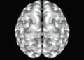 White Matter Microstructure and Brain Network Changes in Children With Global Developmental Delay