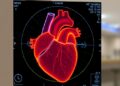 AI-Powered Murmur Detection Could Expand Remote Pediatric Heart Exam Teleconsultations