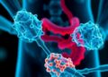 Acacia Catechu Nanocarriers Show Promise Against Dextran Sulfate-Induced Crohn’s Disease