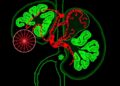 Alcohol reshapes liver zonation and immune-metabolic programming in metabolic syndrome-associated liver cancer