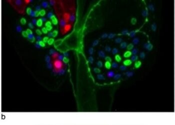 Cancer-associated fibroblast SERPINH1 drives epithelial-mesenchymal transition in clear cell kidney cancer