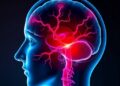 Chinese Neurosurgical Journal study shows LVIS stent alters blood flow in aneurysms