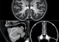 Comprehensive Review of Benchmark Datasets for Deep Learning in Medical Image Segmentation