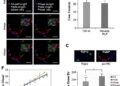 Disrupted TDP-43/RILP pathway impairs cellular cleanup and stress granule balance